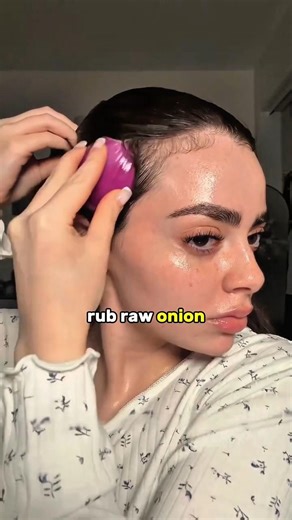 This Is Why Red Onion Never Worked for Your Hair 🧅