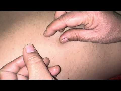 ASMR Sleep in 8mins😴 Back Scratching Massage | #asmr #asmrtriggers #backmassage #asmrbodymassage