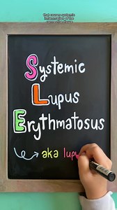 7.7K views · 53 reactions | 曆 Systemic Lupus Erythematosus (SLE)...