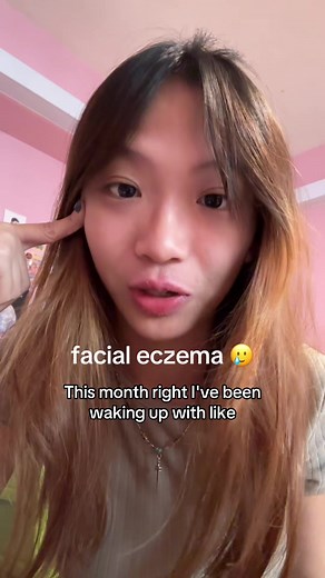 Effective Eczema Creams for Facial Care