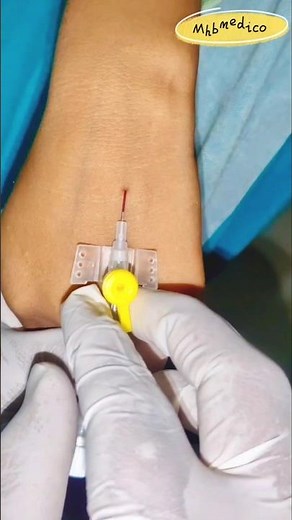 IV Cannula Insertion in Slow Motion | Perfect Needle Technique #Shorts #mhbmedico