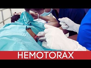 Abordaje y Manejo quirúrgico del Hemotórax