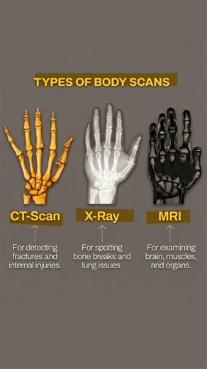 Types of Medical Imaging #Radiology #MRI #X-RAY #CT SCAN #DiagnosticImaging #anatom #RadiologyBasic
