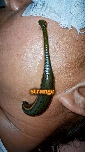 Leeches on your face?! 😳 Before you scroll -here’s why celebs swear by this ancient skincare secret