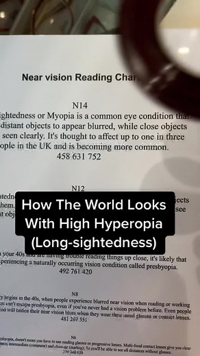 Understanding High Hyperopia: Symptoms and Solutions