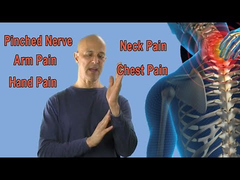 How to Find the Origin of Your Pinched Nerve (Neck Pain, Arm Pain, Hand Pain) - Dr Mandell