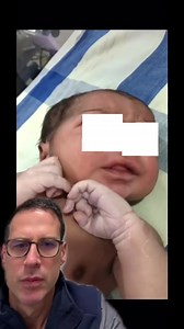 Repetitiv lip smacking without milk anywhere near a baby may be a seizure!#pregnancy #pediatrics #nicu #doctorsoftiktok #nursesoftiktok #neonatology | Dr Michael Narvey