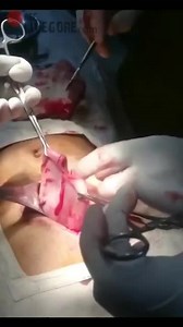 DOCTOR TRYING TO TAKING OUT "THING" FROM PATIENT STOMACH