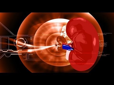 Glomerulonephritis: All you need to know - Dr Deepa Jayaram