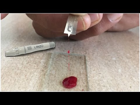 Blood Clotting Time Determination by Slide Method | Blood Clotting Time | Find Blood Clotting Time