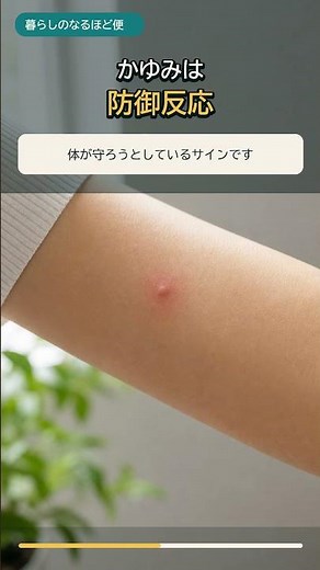 蚊に刺されるとかゆくなる理由とは？ かゆみを落ち着かせる3つのコツ #shorts #雑学