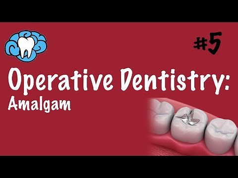 Operative Dentistry | Amalgam | INBDE, ADAT