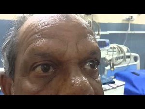 One and half syndrome