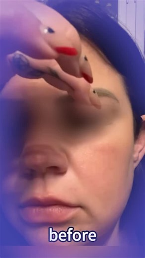 1.7K views · 73 reactions |  “¿Mini Face Lift? No creerás lo natural...