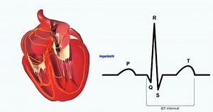 1.1M views · 22K reactions | Heart and ECG | Med G | Facebook