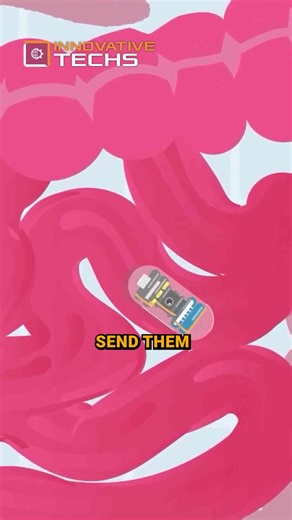 This Small Capsule-Camera Can Improve Your Health