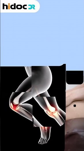 5 Alarming Signs of Bone Cancer #doctor #shortvideo #bonecancer #symptoms