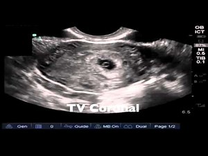 Introduction to pelvic ultrasonography