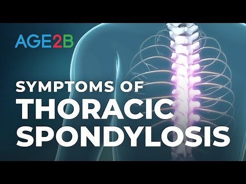 What Are the Symptoms of Thoracic Spondylosis? Thoracic (Mid-Back) Pain or Disc. Spondylolisthesis