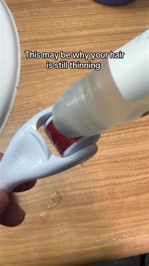 Micro Needling for Hair Growth: Boost Your Hairline