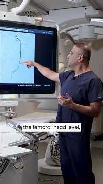 Varicocele Embolization Procedure - Prof. Dr. Özgür Kılıçkesmez