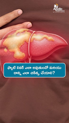 Fatty Liver Is Commonly Linked To Lifestyle And Metabolic Health (Telugu) | Dr Rajesh Lekkala