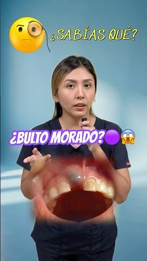 PURPLE LUMP on the gum! 😱 What is an Eruption Cyst?