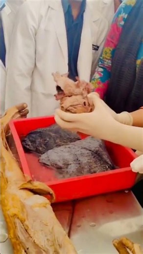 Real Human Heart Anatomy in 30 Seconds 🔬❤️