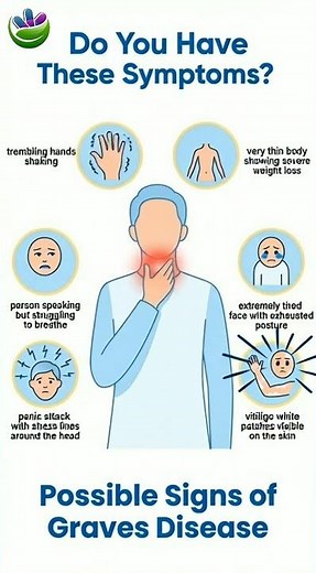 Do You Have These Symptoms? | Possible Signs of Graves Disease