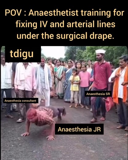 POV:Anaesthetist training for fixing IV and arterial lines under the surgical drape.#medicalmemes
