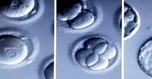 Designer Baby Next? US Scientists Modify Genes Of Human Embryo |