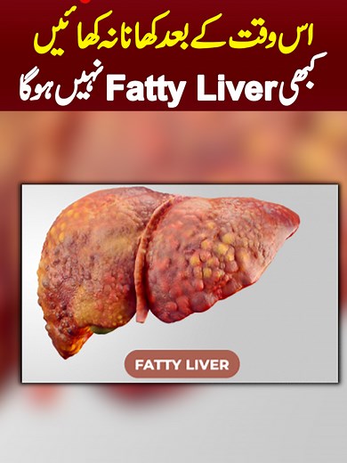 Fatty Liver: Symptoms, Causes, and Effective Treatments
