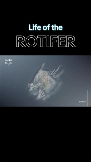 These are Rotifer. Rotifer are microscopic organisms. Rotifer are microscopic aquatic invertebrates also called Wheel Animals. Rotifer are seen using microscopes. Microscopes help scientists to better understand how life works.