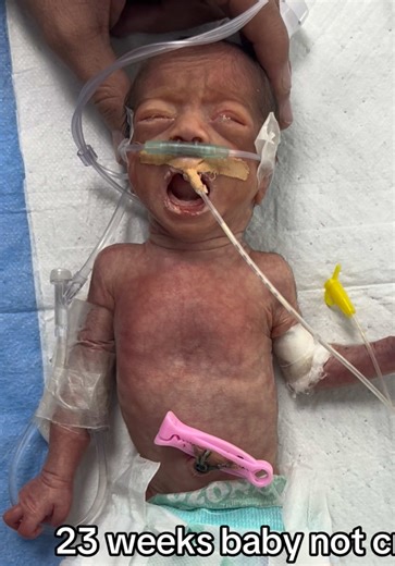 What to Expect from a 23-Week Baby Who Doesn't Cry