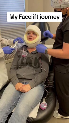 My facelift journey #facelift #faceliftsurgery #yolo #beautyisexpensive | Hospicenursepenny