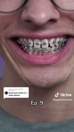 How to Properly Brush Teeth with Braces - Best Techniques Revealed