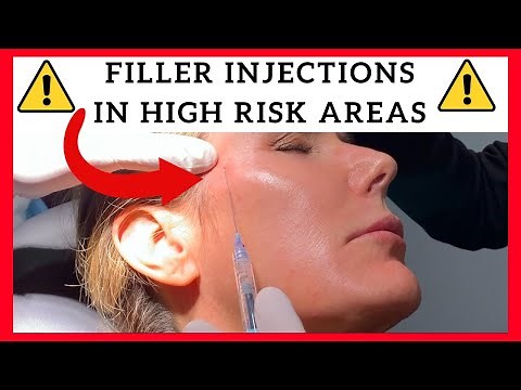 Filler Injections in High Risk Areas-- Temples, Forehead, Tear Trough, Preauricular, and Jawline