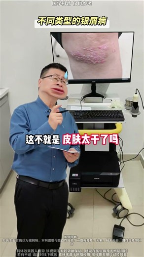 这些常见皮肤问题，可能是银屑病！一定要注意区分并及时尽早处理！#银屑病 #牛皮癣 #涨知识 #我的年度健康盘点 #抖出健康知识宝藏