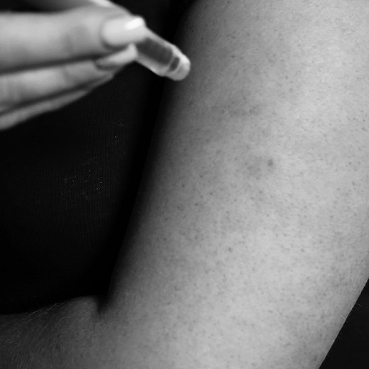 3.9K views · 330 reactions | Dupixent is a medication for allergic diseases and has been linked to an increased risk of Cutaneous T-Cell Lymphoma (CTCL). If this sounds like you, contact us today to see if you're eligible for compensation. | Goldwater Law Firm | Facebook