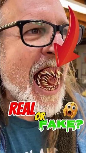 "The Creepiest Teeth You’ll Ever See!" #weird #shorts #creepy