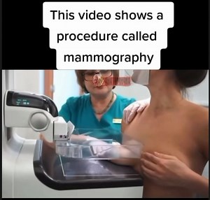 A demonstration of what a mammogram looks like ✨ #Radiology | One Day You May