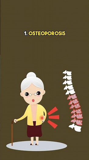 Deficiency of calcium symptoms #hypocalcemia #lowcalcium #calciumdeficiency