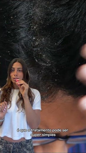 Yes, anti-dandruff shampoo bars that really work! ✅ Buy online or in physical stores.