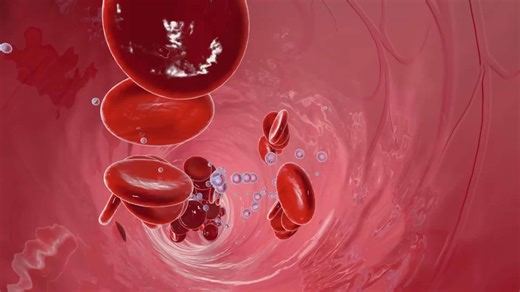 Iron deficiency anemia signs