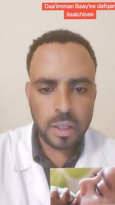 23K views · 915 reactions | DAA'IMMAN BAAY’EE DAFQAN ILAALCHISEE. Bal'inaan youtube irraa argachuu dandeessu ..  https://youtu.be/x_WvTkPo3JE?s | Dr Abera Olani | Facebook