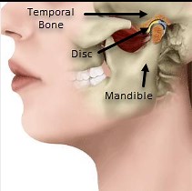 Why Does My Jaw Click? | Physiotherapy Manly