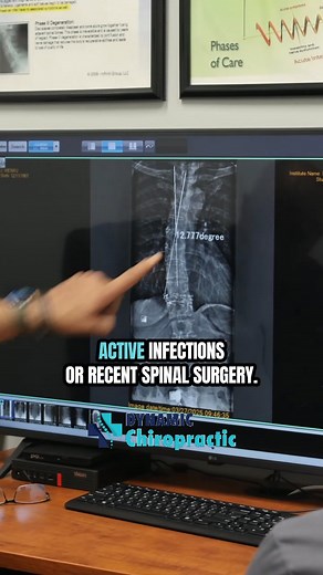 ✅Who’s the Best Candidate for Spinal Decompression? 領 If you’re...