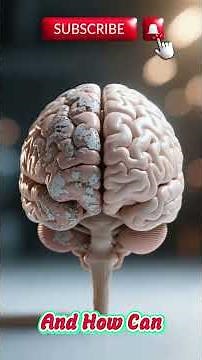 Alzheimer’s was explained as a brain problem caused by plaques and tangles #healthyaging #healthy