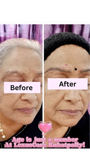 😱 This 60-Year-Old's Eyebrow Transformation Will SHOCK You! #beauty #lexuscare #skincare