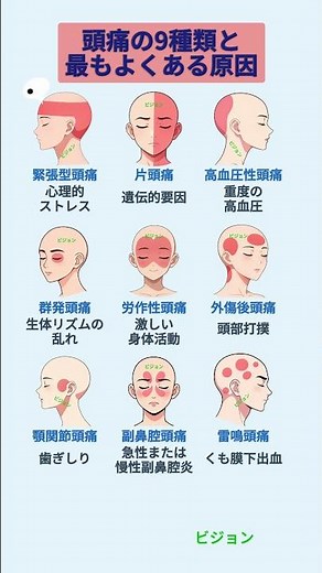 頭痛の9種類と最もよくある原因
